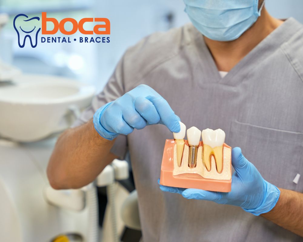 Essential Tips on How to Properly Care for Your Dental Implants for Longevity